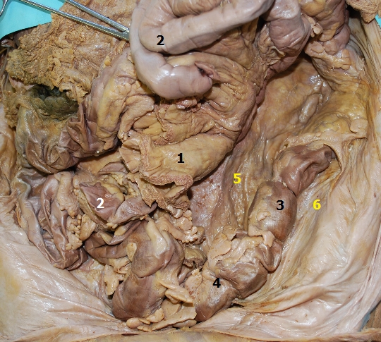 Mesocolon transversum et mesenterium (2)