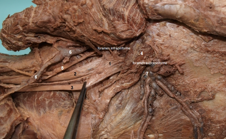 Vstupy nerv a cv z foramen supra- a infrapiriforme