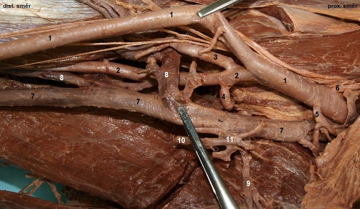 Fossa iliopectinea (detail)