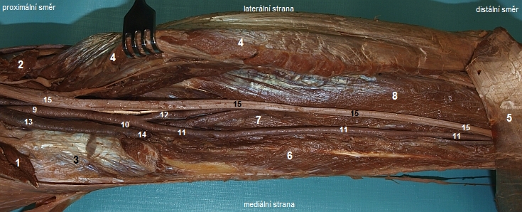 Pehled tvar na zadn stran brce (m. triceps surae odklopen)