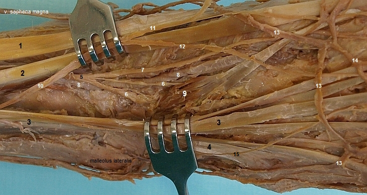 Prbh a vtven n. peroneus (fibularis) prof. na hbetu nohy (2)