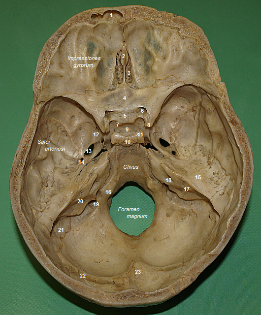 Basis cranii interna