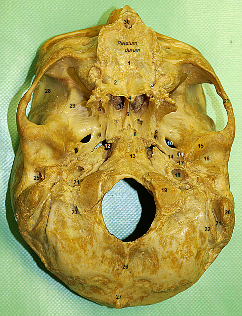 Basis cranii externa