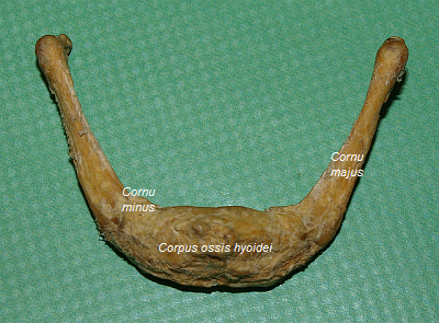 Os hyoideum (shora)